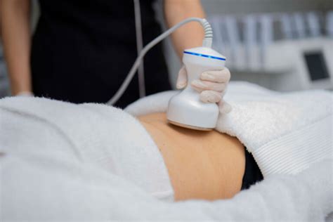 fat cavitation parramatta